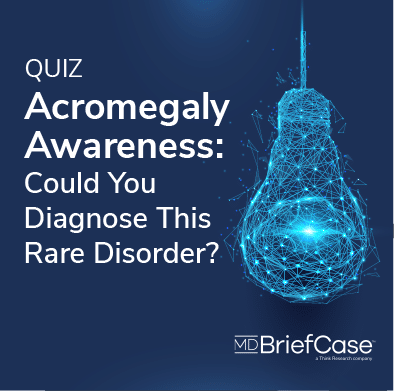 [QUIZ] Acromegaly Awareness: Test Your Knowledge of This Rare Disorder ...