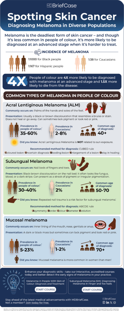 Melanoma in people with skin of colour infographic